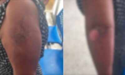 Violento sujeto le prende fuego a su pareja.