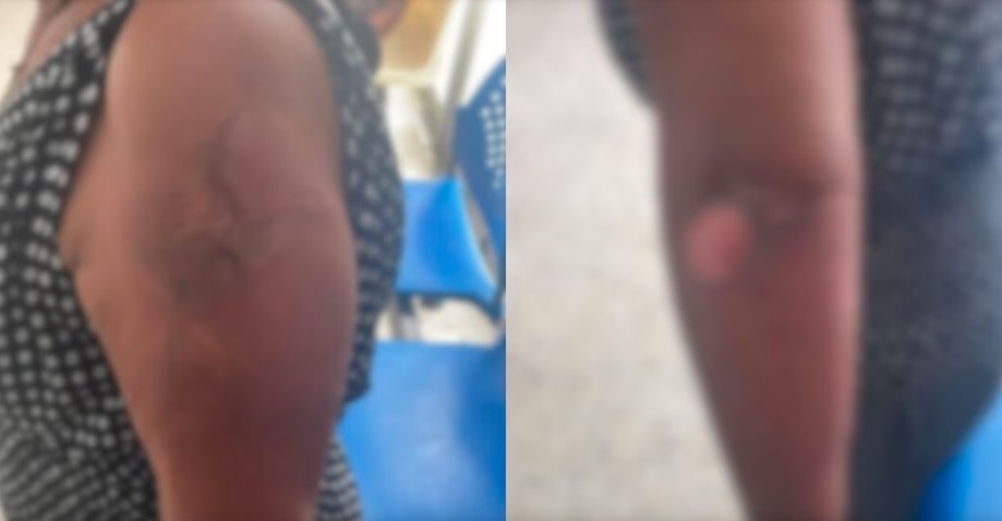 Violento sujeto le prende fuego a su pareja.