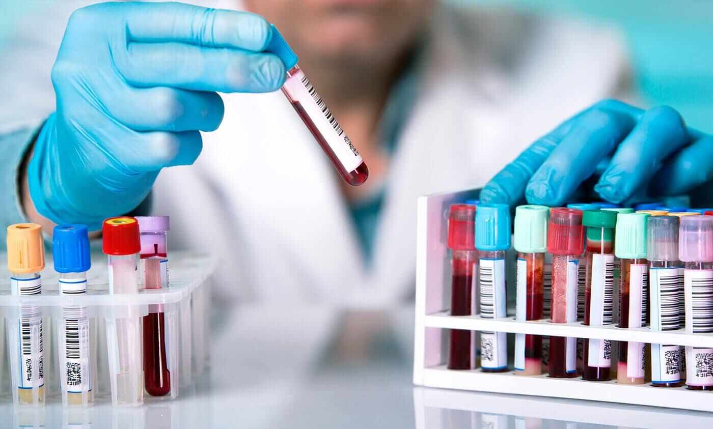 Detectado origen de virula símica en Congo