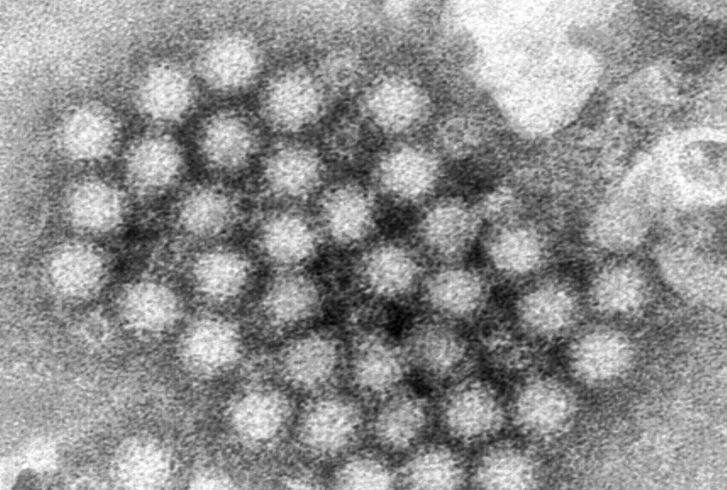 Autoridades encienden alertas por Norovirus, enfermedad mortal altamente contagiosa