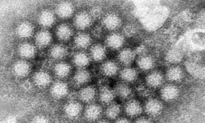 Autoridades encienden alertas por Norovirus, enfermedad mortal altamente contagiosa