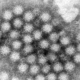 Autoridades encienden alertas por Norovirus, enfermedad mortal altamente contagiosa