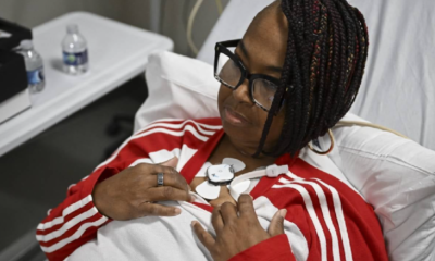 Una mujer fue trasplantada con un riñón de cerdo modificado genéticamente