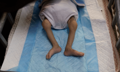 Al menos 57 niños han muerto de hambre en Gaza por bloqueo israelí, estima OMS