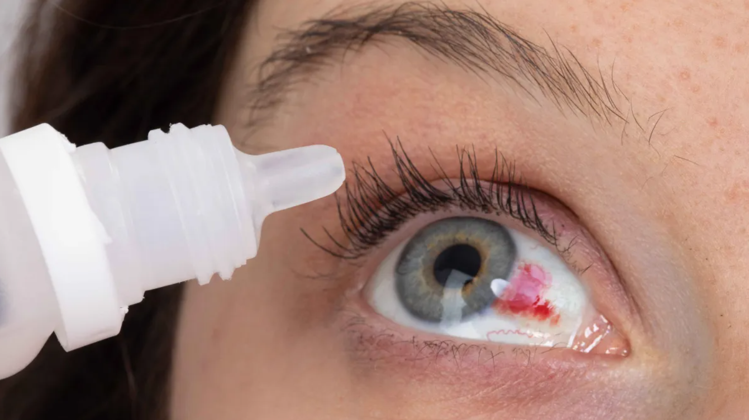 Retiran del mercado 5 tipos de GOTAS OFTÁLMICAS, causan infecciones oculares graves