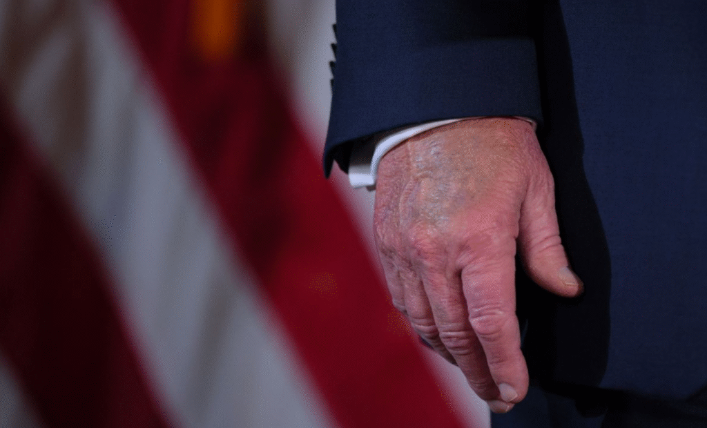 Casa Blanca confirma: Este es el problema de salud que padece Trump