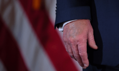 Casa Blanca confirma: Este es el problema de salud que padece Trump