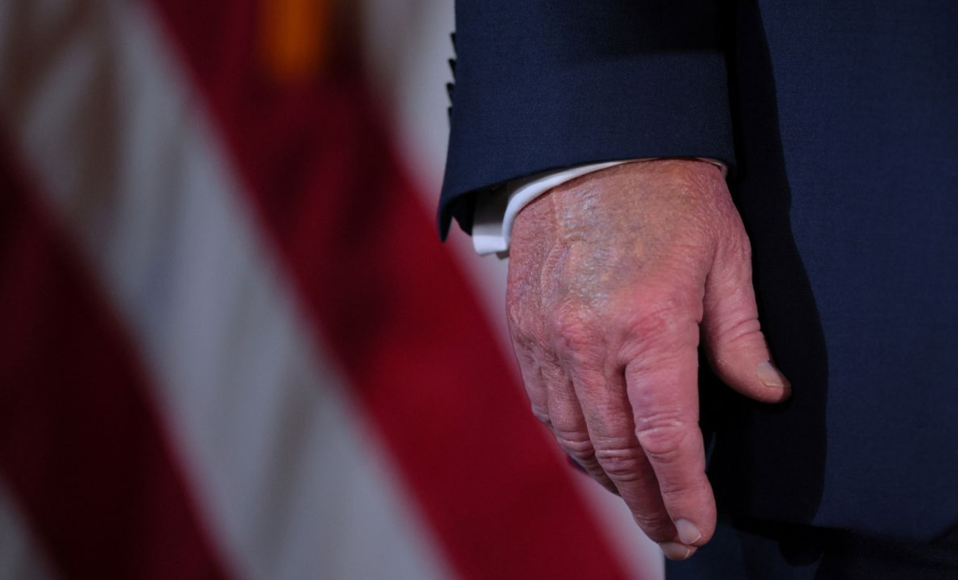 Casa Blanca confirma: Este es el problema de salud que padece Trump