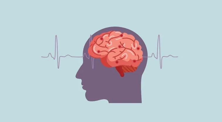Detectar a tiempo los síntomas del Ictus, fundamental para salvar vidas