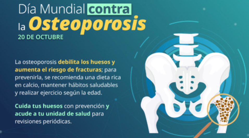 Secretaría de Salud prioriza acciones para prevenir y combatir la osteoporosis