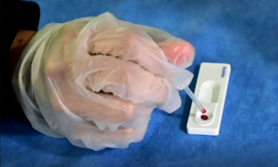 Promueven detección oportuna de Hepatitis C mediante pruebas voluntarias