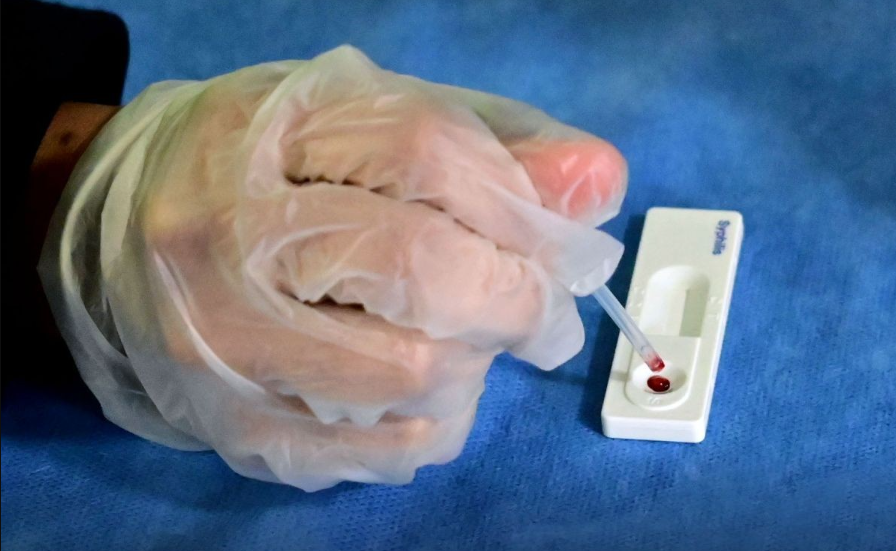 Promueven detección oportuna de Hepatitis C mediante pruebas voluntarias