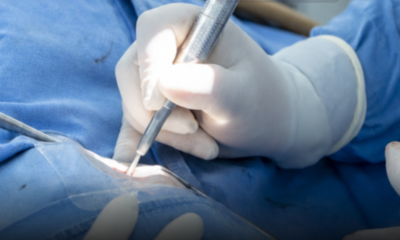 Primer implante coclear bilateral exitoso en el Hospital Juárez