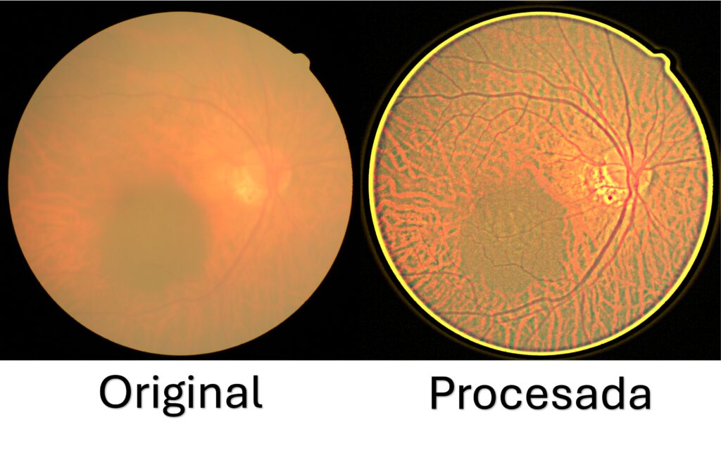 Desarrolla UPT sistema de bajo costo para mejorar imágenes de retina