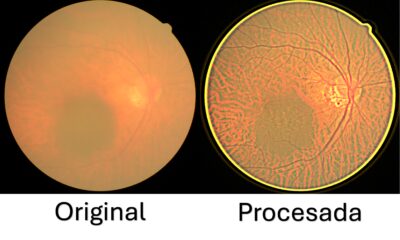 Desarrolla UPT sistema de bajo costo para mejorar imágenes de retina