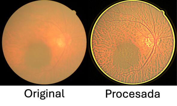 Desarrolla UPT sistema de bajo costo para mejorar imágenes de retina