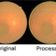 Desarrolla UPT sistema de bajo costo para mejorar imágenes de retina
