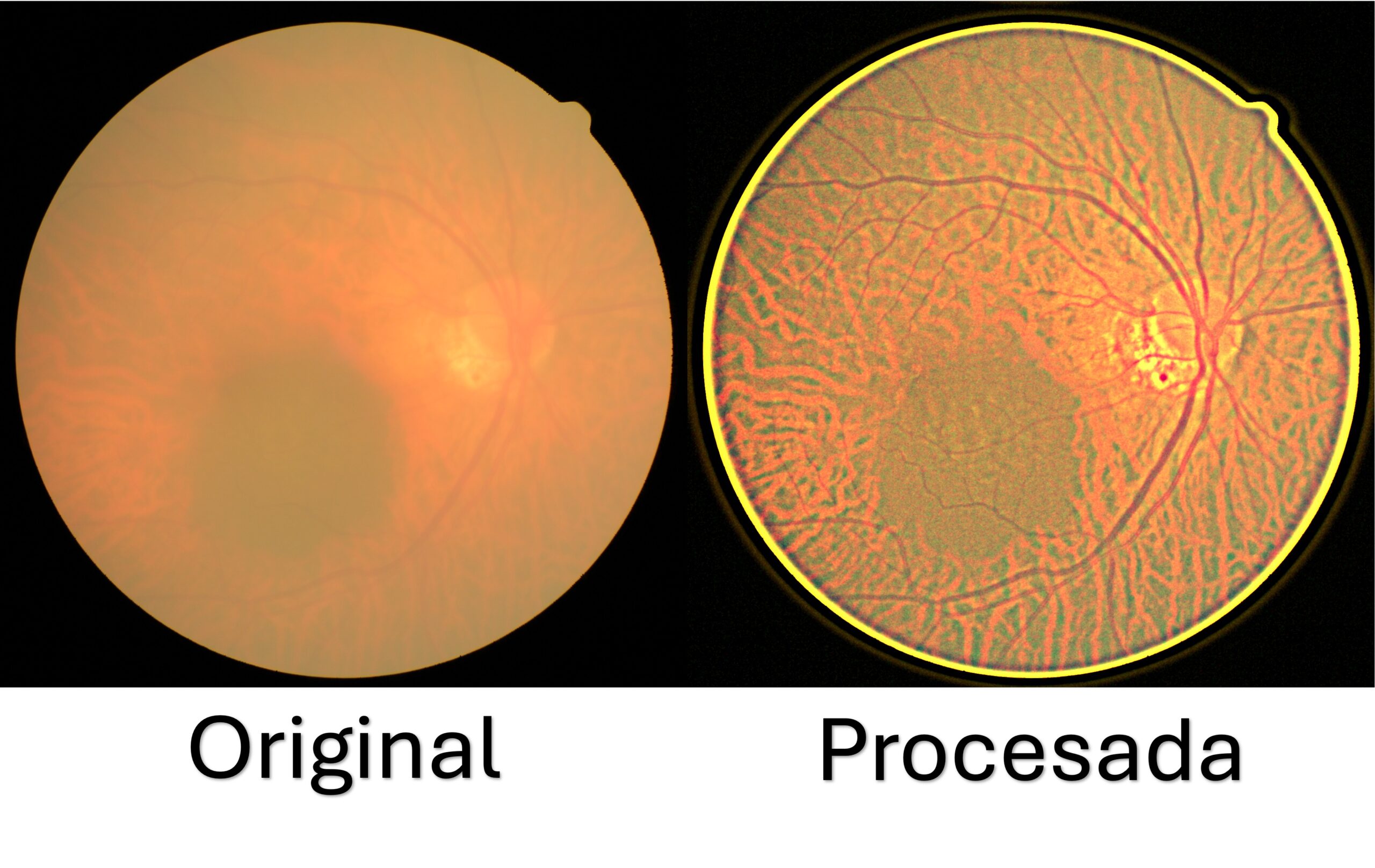 Desarrolla UPT sistema de bajo costo para mejorar imágenes de retina